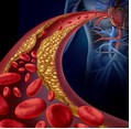 Régulation génique et pathologies cardiométaboliques